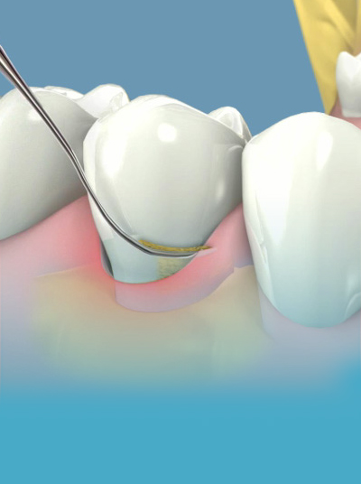 Periodoncia-005