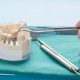 implantes dentales en adeje